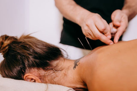 Precision Healing: Unveiling the Benefits of Active Edge Dry Needling Therapy